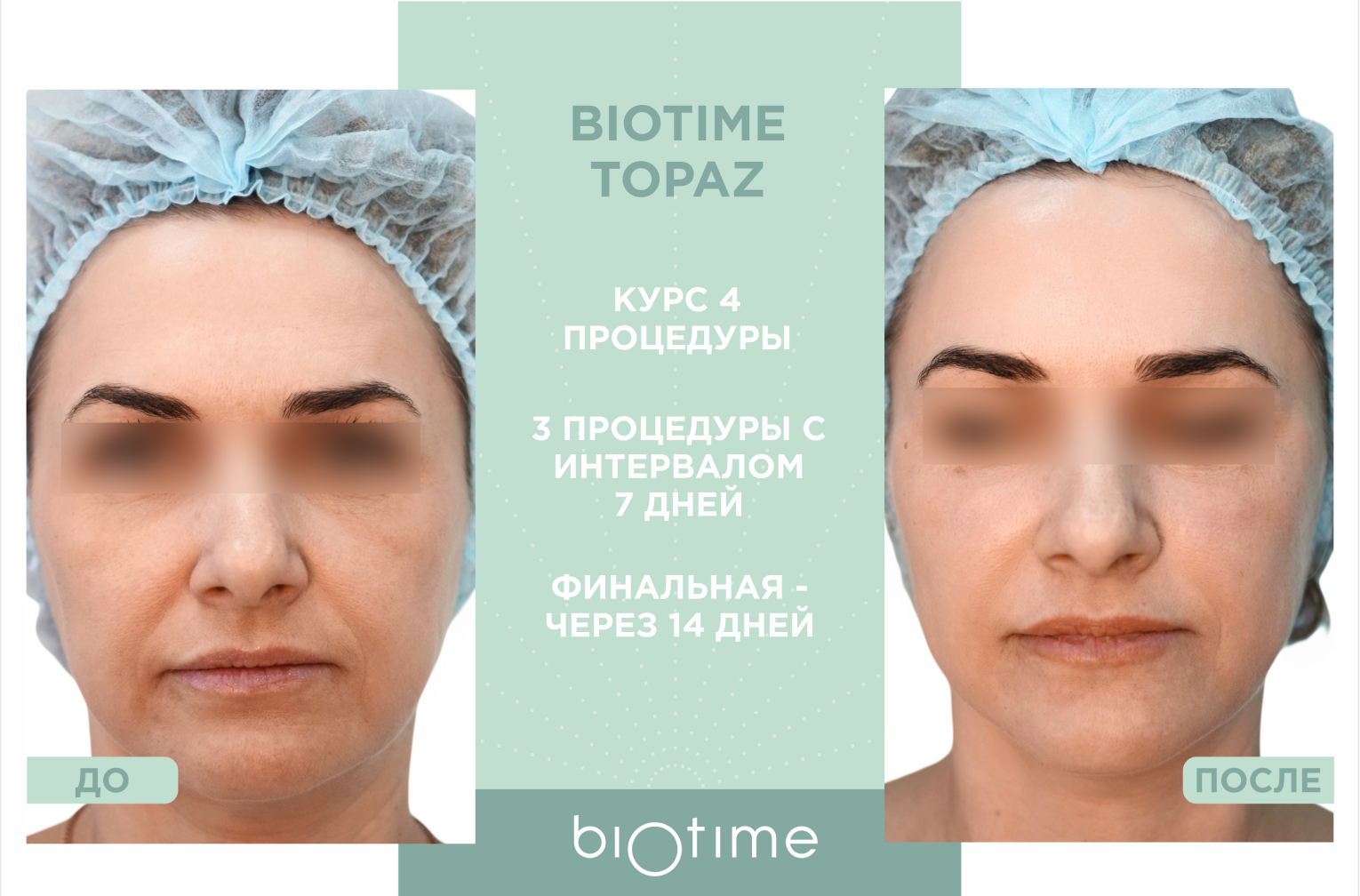 biotime TOPAZ в Екатеринбурге